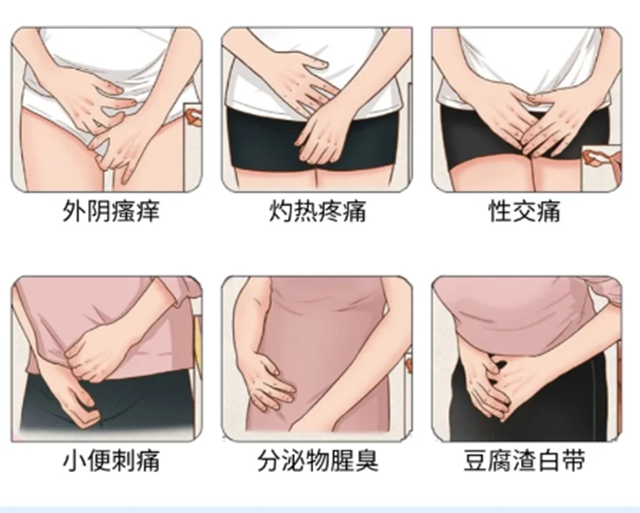 “破案了”，妇科炎症是这么来的