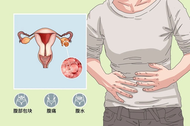 【围观】16岁花季少女“怀了个怪胎”,重达8斤......(图6) 微信图片_20240913092631.jpg