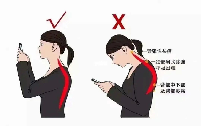 【扩散】手指发麻、低头肩膀痛，赶紧自查