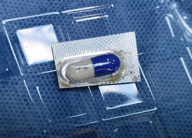 80岁奶奶竟把胶囊包装吞下，医生妙手“缉凶”