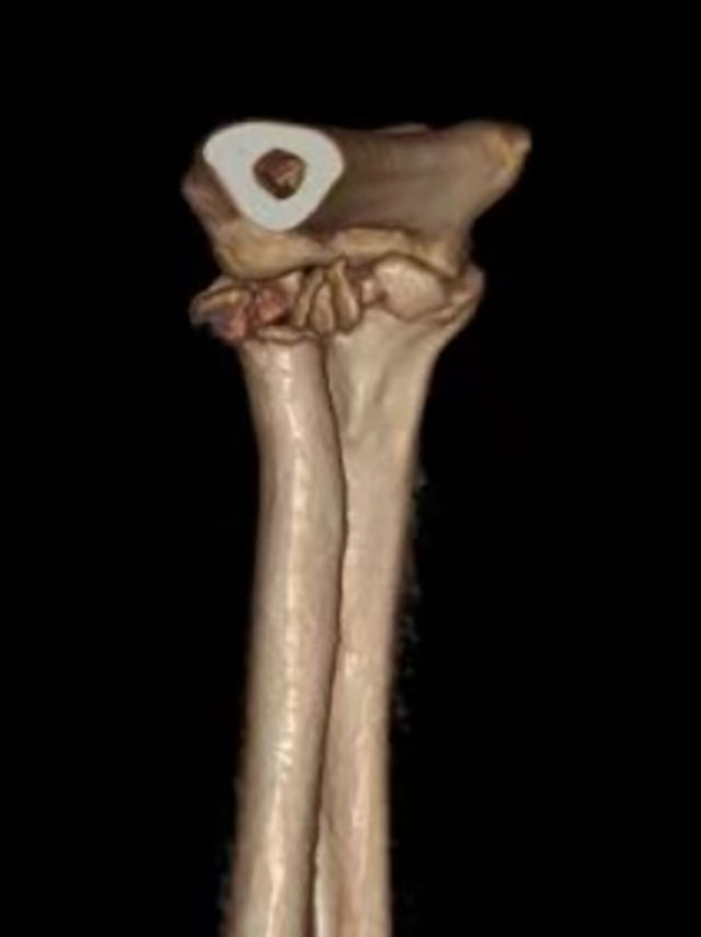 【围观】泸州一嬢嬢路上被车撞，“恐怖”……