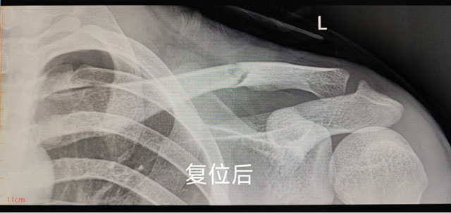 【围观】时隔一年,泸州又一“爬树哥”遭了(图2) 2.jpg