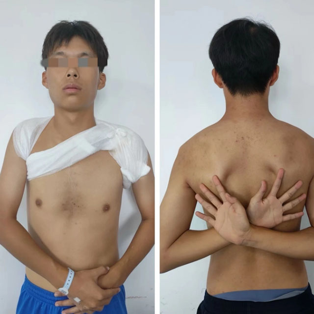 【围观】时隔一年,泸州又一“爬树哥”遭了(图3) 3.jpg