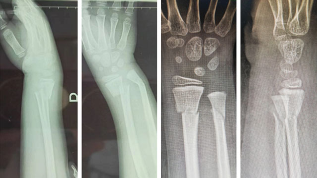 【围观】时隔一年,泸州又一“爬树哥”遭了(图5) 6.jpg