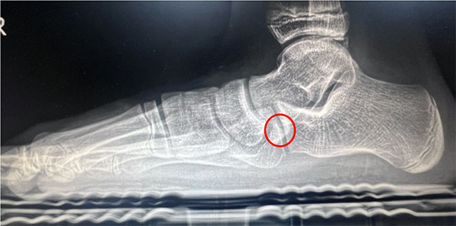 【扩散】又一明星自爆“铲子脚”!原来谢霆锋、阮经天都是(图4) 4.jpg