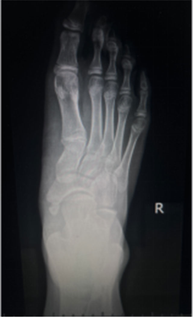 【扩散】又一明星自爆“铲子脚”!原来谢霆锋、阮经天都是(图5) 5.jpg