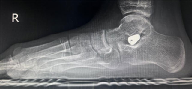 【扩散】又一明星自爆“铲子脚”!原来谢霆锋、阮经天都是(图6) 6.jpg