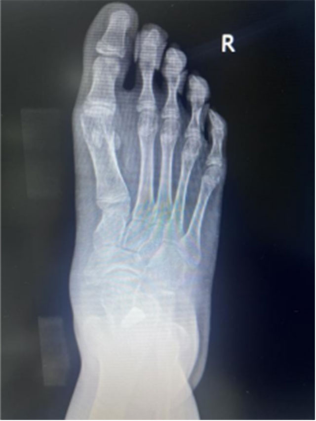 【扩散】又一明星自爆“铲子脚”!原来谢霆锋、阮经天都是(图7) 7.jpg