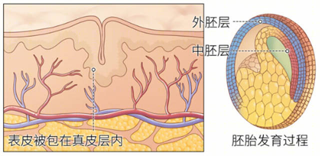 【围观】男子背上长“痘痘”，还能挤出“豆腐渣”……