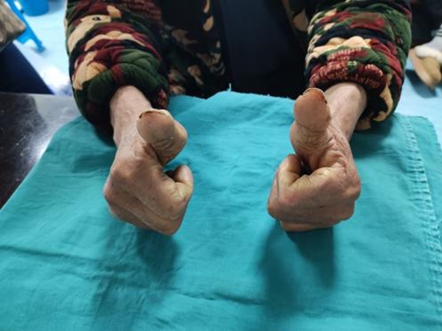 【围观】男子遭遇车祸，伤情复杂......