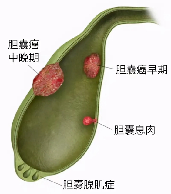 护士4.jpg