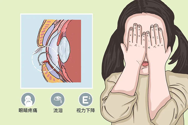 【围观】木签扎入眼中,泸州男子求医生挖掉眼睛(图5) 5.jpg