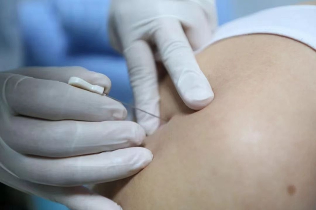 下班也能做推拿|西南医大中医院针灸推拿夜间门诊开诊(图3) 3.jpg