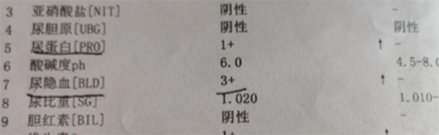 【警惕】女子一家三代都有血尿，外婆、妈妈、舅舅都遭了，有这些症状要当心