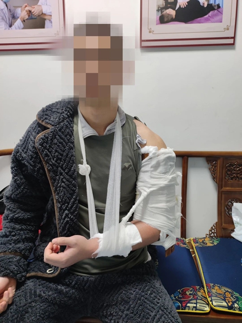 【围观】男子掰手腕,骨折了……(图7) 骨折7.jpg