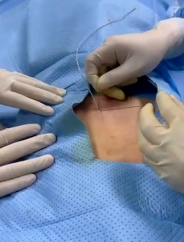 【围观】男子会阴长满疱疹,刺痛不已……(图2) 640-(1).jpg