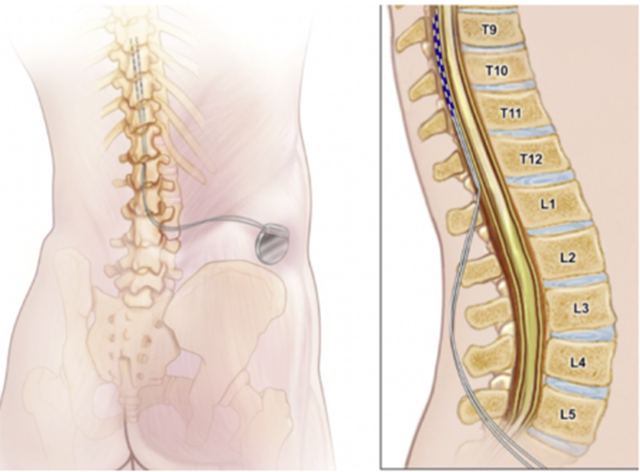 【围观】男子会阴长满疱疹,刺痛不已……(图4) 640-(4).jpg