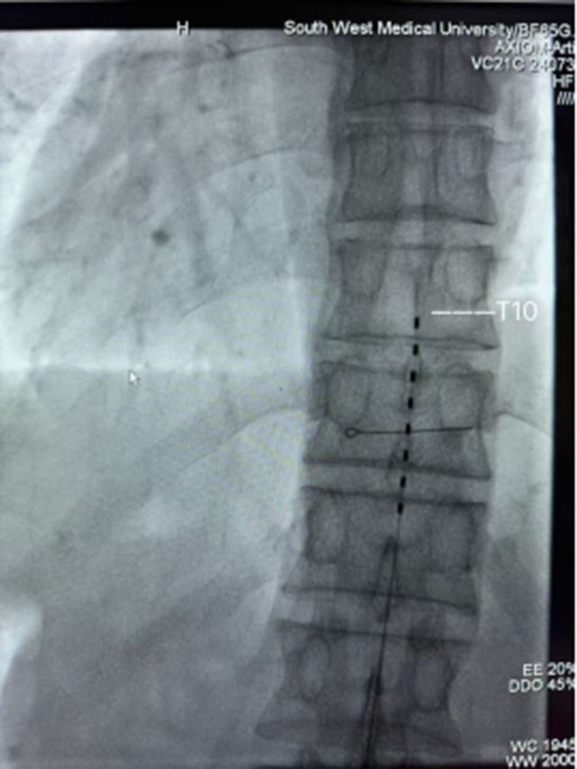 【围观】男子会阴长满疱疹,刺痛不已……(图4) 640-(1).jpg
