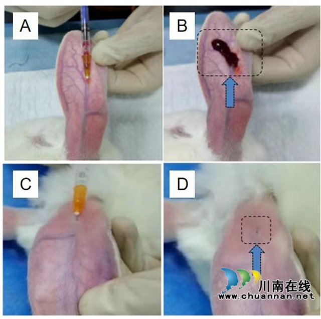 西南医科大学本科生科研成果展示:创新原位止血针,引领医疗止血新变革(图4) 成果4.jpg