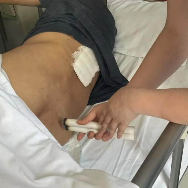 【关注】男子从3米高空坠落,结果……(图3) 3_副本.jpg