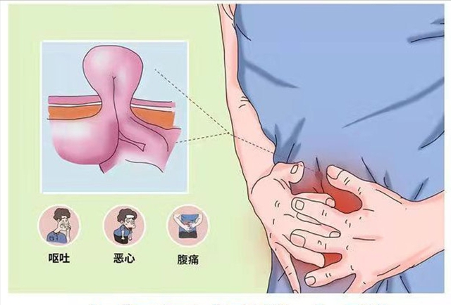 【关注】大爷肚子鼓起半个“足球”大包，竟是……