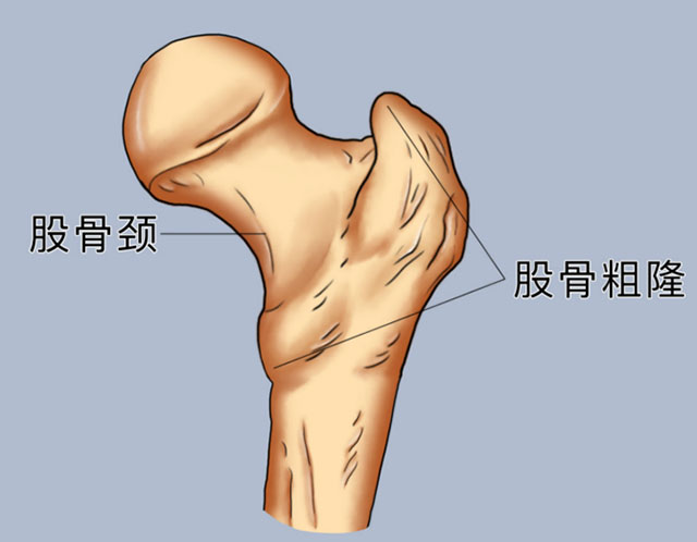 【当心】股骨颈骨折:这可能是你最后一次骨折!(图2) 2.jpg