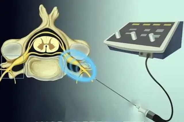 嬢嬢头上长满小水疱，迷信“烧灯花”偏方，遭折磨惨了