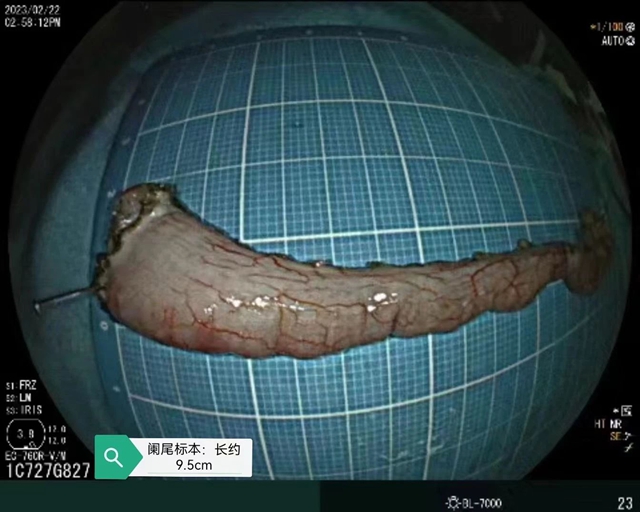 肛肠科两名见多识广的帅哥医生来了(图4) 4.jpg