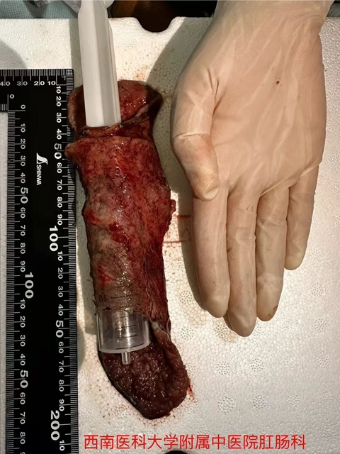 肛肠科两名见多识广的帅哥医生来了(图5) 5.jpg