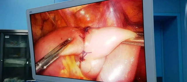 肛肠科两名见多识广的帅哥医生来了(图7) 8.jpg