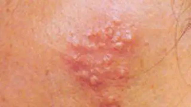 Double kill！女子被“蛇”缠上了脸