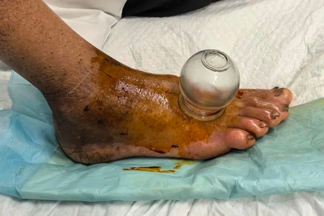 【吓人】泸州2米长蛇溜进小区……(图4) 蛇4.jpg