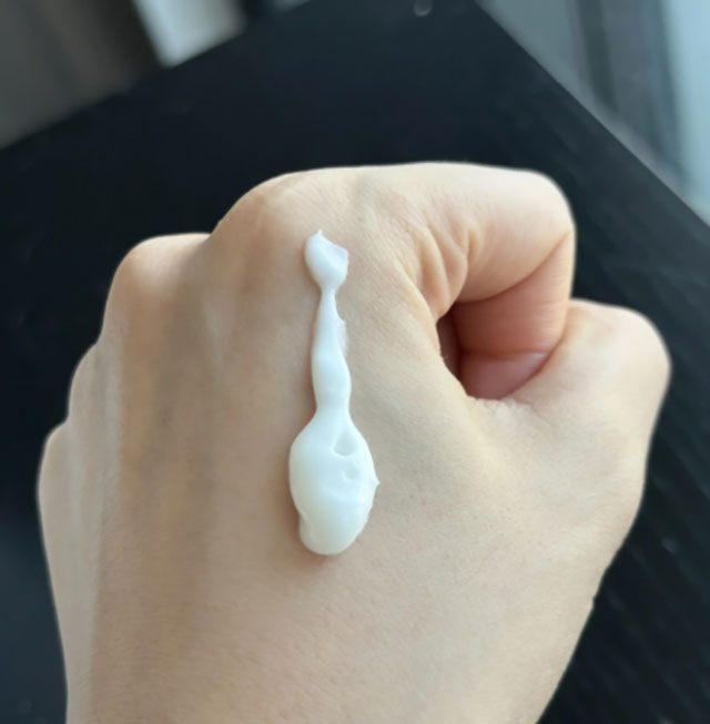 洗澡后“脱皮”、长“鱼鳞”!当心是这2种疾病作怪!(图2) 2.jpg