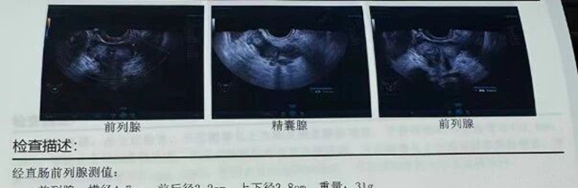 男子半小时3趟厕所,天天夜尿2趟,竟是这些生活小习惯导致,90%成人都有!(图1) 1.jpg