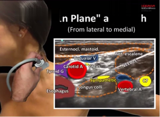 嘴角出现这种小水泡,当心遭……(图5) 水5.jpg