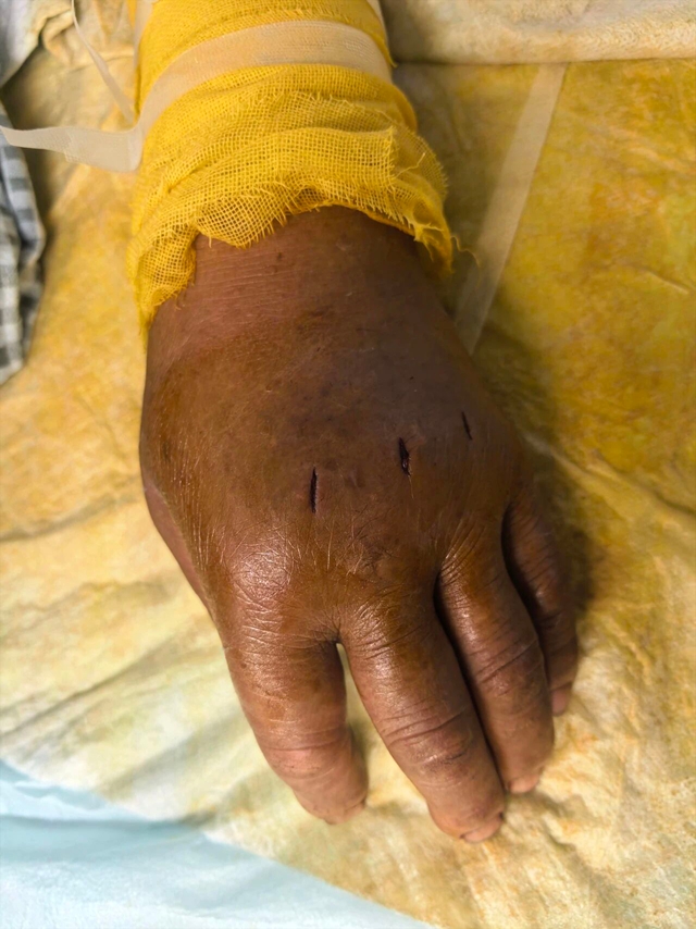 今年首例,毒蛇开始咬人了!(图5) 蛇5.jpg