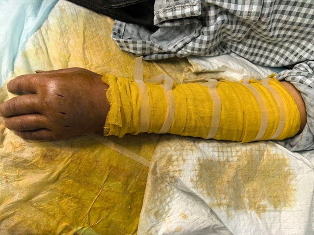 今年首例,毒蛇开始咬人了!(图4) 蛇4.jpg