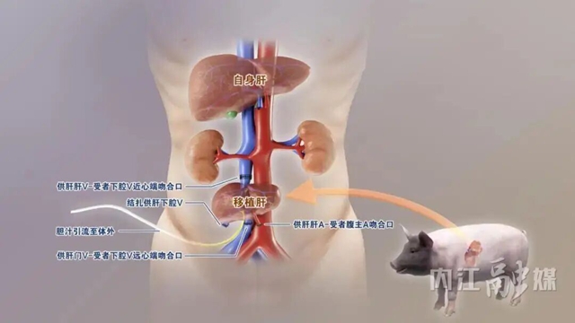 2025年度“中国科学十大进展”发布,内江“猪猪侠”又立大功!(图1) 1.jpg