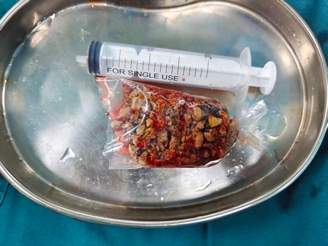 西南医大中医院又一新门诊开诊!(图3) 百3.jpg