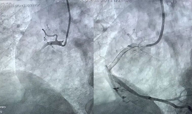 25院!800公里!西南医科大学附属中医医院心血管内科硬核出击(图4) 4.jpg