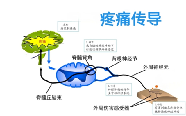 别硬扛!疼痛不是小事,是身体给你的紧急预警(图2) 医2.jpg