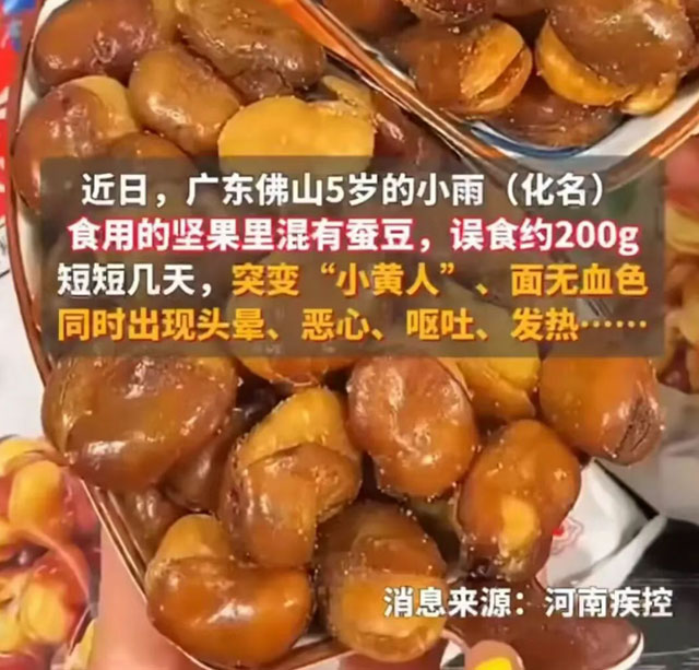 “菜市场不准剥蚕豆”引发热议!医生提醒:这类人碰都不能碰(图3) 3.jpg