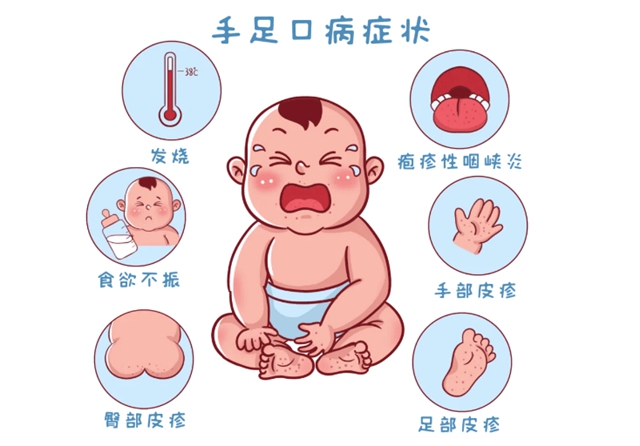 【科普】天一热,这个病爱“盯”上娃,传染性强→(图1) 手1.jpg