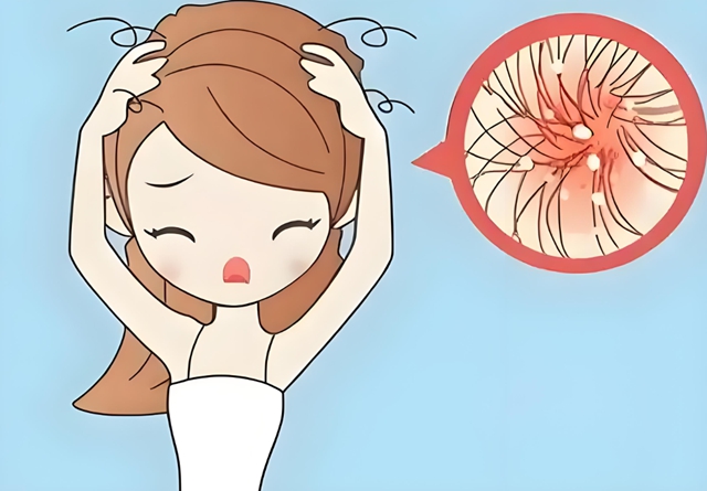 夏天头皮长脓包?别错怪了“上火”(图1) 1.jpg