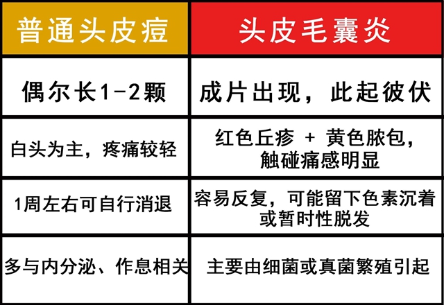 夏天头皮长脓包?别错怪了“上火”(图4) 4.jpg