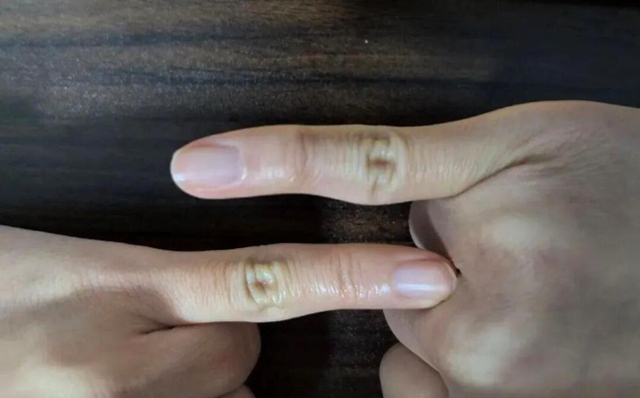 你还在用小拇指托手机,已经有人遭了……快改(图2) 手机2.jpg
