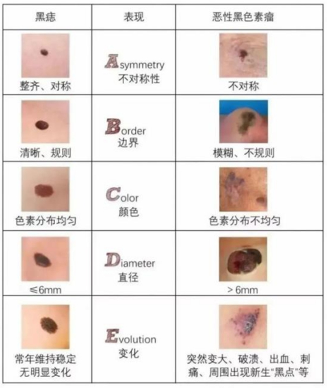 每年染发2次,10年后确诊癌症!(图5) 5.jpg