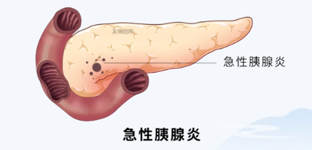 2天收治8名患者,有人病情恶化住进ICU,近期一定要注意(图2) 2.jpg