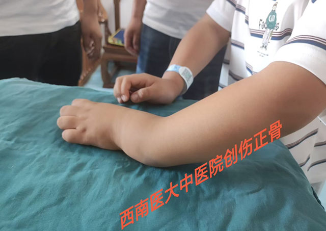 多名小孩手臂被da弯,结果……(图1) 1.jpg