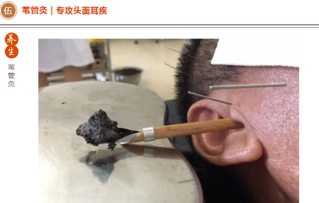 熬夜、贪凉、湿气重?越养越虚的根源找到了!(图8) 9.jpg